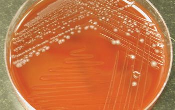 Clostridium hathewayi (Hungatella hathewayi) Blood Agar 48h culture anaerobicly incubated