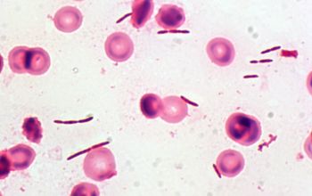 Clostridium hathewayi (Hungatella hathewayi) Gram stain