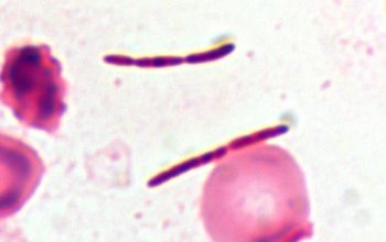 Clostridium hathewayi (Hungatella hathewayi) 
