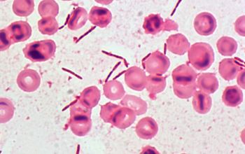 Clostridium hathewayi (Hungatella hathewayi) Gram stain