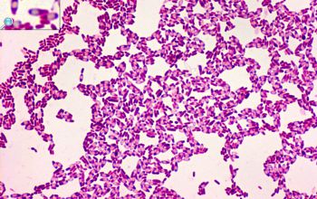 Clostridium histolyticum (Hathewaya histolytica) Gram stain