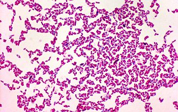 Clostridium histolyticum (Hathewaya histolytica) 