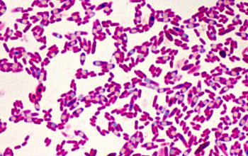 Clostridium histolyticum (Hathewaya histolytica) Gram stain