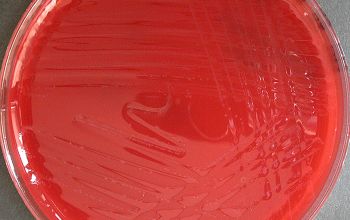 Clostridium histolyticum (Hathewaya histolytica) Brucella Blood Agar 48h culture anaerobicly incubated