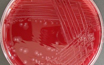 Clostridium histolyticum (Hathewaya histolytica)  culture anaerobicly incubated