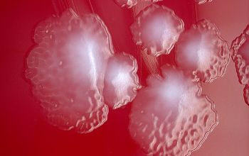 Clostridium histolyticum (Hathewaya histolytica)  culture anaerobicly incubated