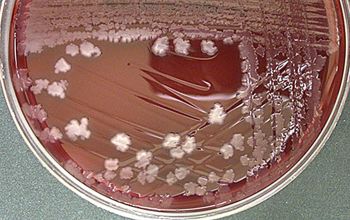 Clostridium limosum (Hathewaya limosa) Brucella Blood Agar 48h culture anaerobicly incubated