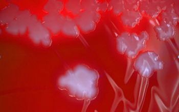 Clostridium limosum (Hathewaya limosa) Brucella Blood Agar 48h culture anaerobicly incubated