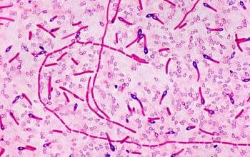 Clostridium limosum (Hathewaya limosa) Gram stain