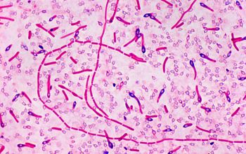 Clostridium limosum Gram stain