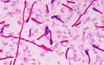 Clostridium limosum (Hathewaya limosa) Gram stain