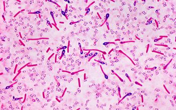 Clostridium limosum Gram stain