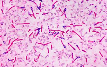 Clostridium limosum (Hathewaya limosa) Gram stain
