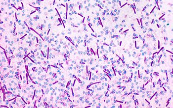 Clostridium limosum (Hathewaya limosa) Wirtz stain