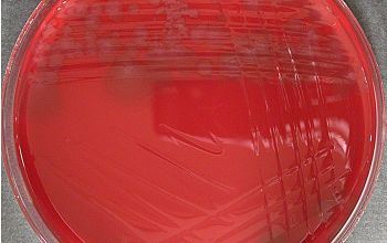 Clostridium novyi type A Brucella Blood Agar 24h culture anaerobicly incubated