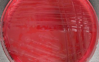 Clostridium novyi type A Brucella Blood Agar 48h culture anaerobicly incubated