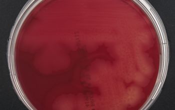 Clostridium perfringens Brucella Blood Agar 48h culture anaerobicly incubated