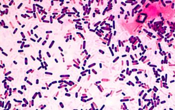 Clostridium perfringens Gram stain