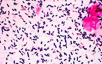 Clostridium perfringens Gram stain