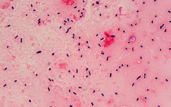 Clostridium perfringens Gram stain