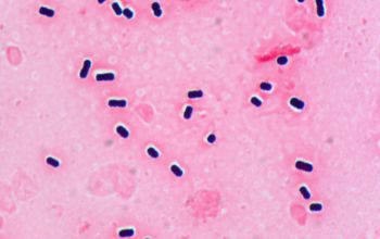 Clostridium perfringens Gram stain