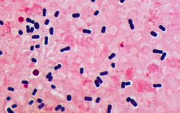 Clostridium perfringens Gram stain