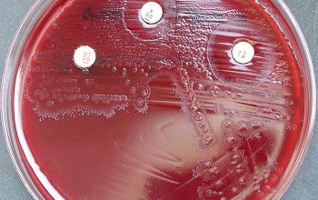 Clostridium perfringens Brucella Blood Agar 48h culture anaerobicly incubated