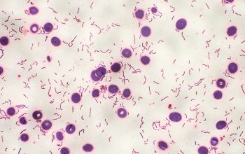 Clostridium ramosum Gram stain
