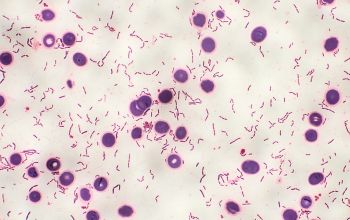 Clostridium ramosum (Thomasclavelia ramosa) Gram stain
