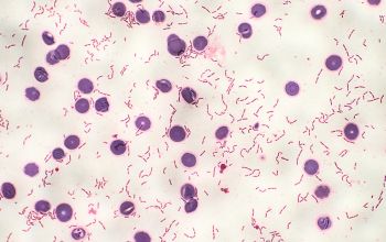 Clostridium ramosum Gram stain