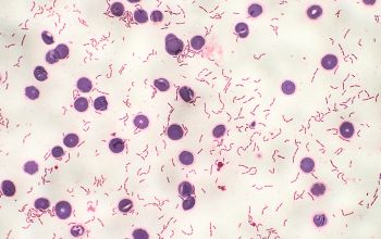 Clostridium ramosum (Thomasclavelia ramosa) Gram stain