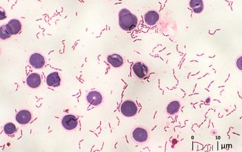 Clostridium ramosum (Thomasclavelia ramosa) Gram stain