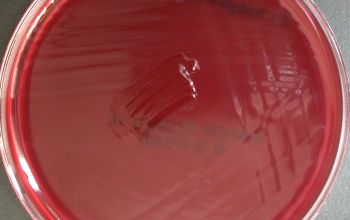 Clostridium septicum Brucella Blood Agar 24h culture anaerobicly incubated