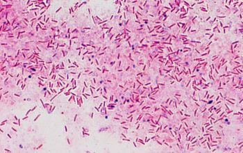 Clostridium septicum Gram stain