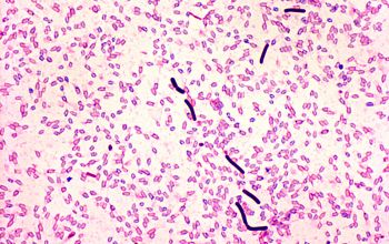 Clostridium sordellii (Paraclostridium sordellii) Gram stain