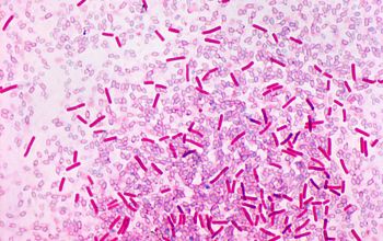 Clostridium sordellii (Paraclostridium sordellii) Wirtz stain