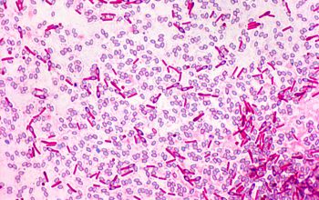 Clostridium sporogenes Wirtz stain