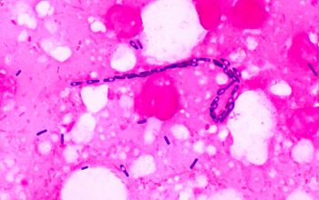 Clostridium sporogenes Gram stain