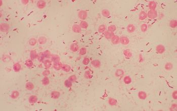 Clostridium tertium Gram stain