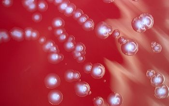 Clostridium tertium  culture anaerobicly incubated