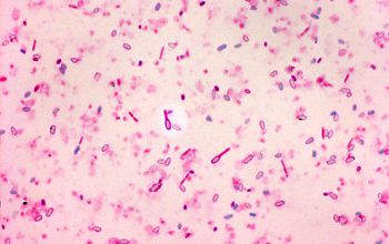 Clostridium tertium Wirtz stain