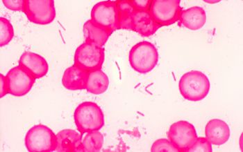 Clostridium tertium Gram stain