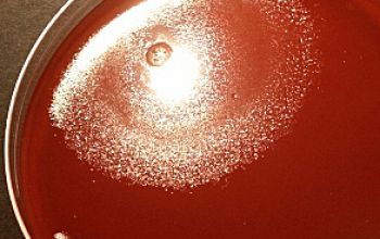 Clostridium tetani Brucella Blood Agar 24h culture anaerobicly incubated