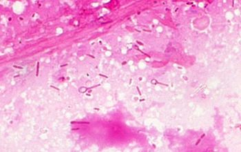 Clostridium tetani Gram stain