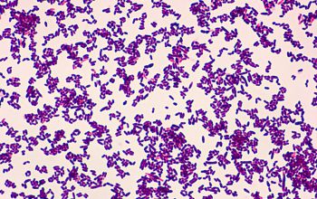 Corynebacterium accolens Gram stain