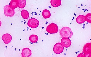 Corynebacterium accolens Gram stain