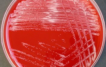 Corynebacterium amycolatum Blood Agar 24h culture incubated with O2