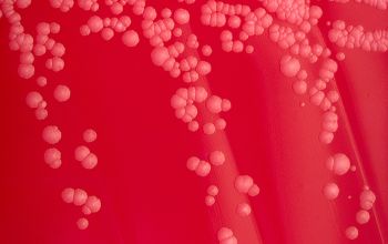Corynebacterium amycolatum Blood Agar 24h culture incubated with O2