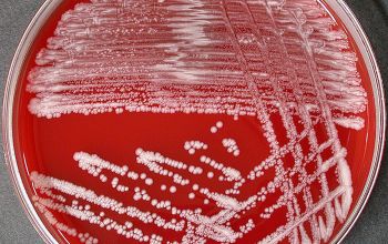 Corynebacterium amycolatum Blood Agar 48h culture incubated with O2