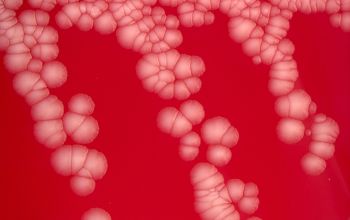 Corynebacterium amycolatum Blood Agar 48h culture incubated with O2